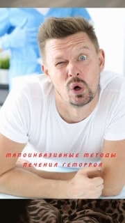 Малоинвазивные методы лечения геморроя