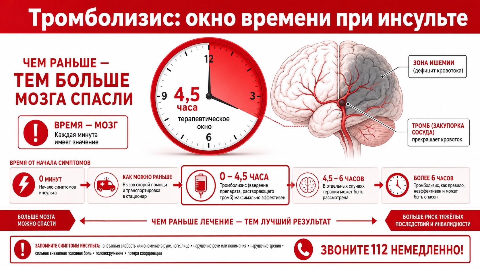 Тромболизис и тромбэкстракция: как современная медицина растворяет тромб в мозге за часы